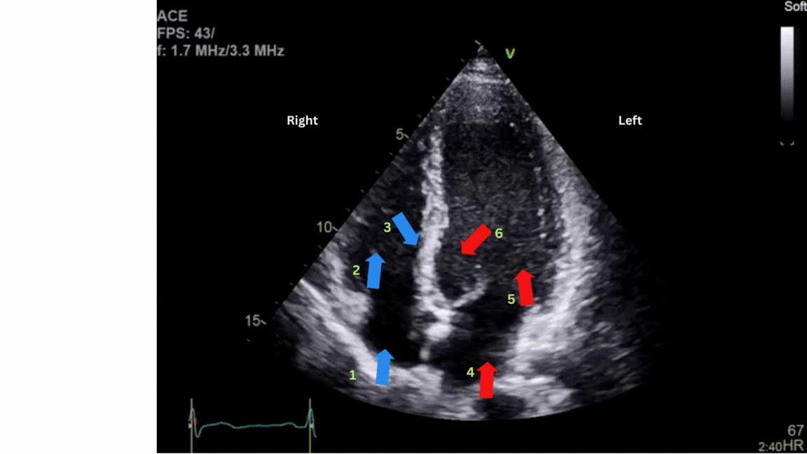 Moving image (GIF) showing an ultrasound of a healthy heart with directive arrows